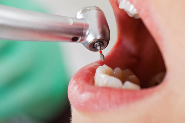 Best Root Canal Emergency Dentist  in Glen Lyon, PA